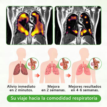 𝐓𝐢𝐞𝐧𝐝𝐚 𝐨𝐟𝐢𝐜𝐢𝐚𝐥 🍈𝐌𝐮𝐫𝑤𝗈𝒏® Difusor Botánico de Mullein para Limpieza de Pulmones (🫁 Tos, faringitis, dificultad para respirar, flema, congestión nasal, bronquitis, síntomas alérgicos, malestar pulmonar)1🎉🎉