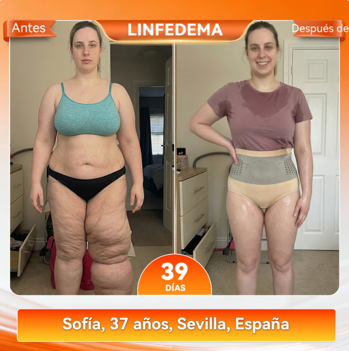 Boutique Oficial de la Marca💜𝑩𝑳𝑼𝑬𝑺𝑯𝑶𝑻® 2026 – Pantalones Cortos 4 en 1 con Micro-Partículas de Moringa & Berberina para Moldear y Quemar Grasa
